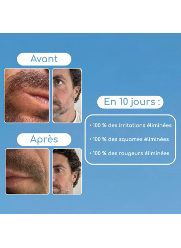 Gel Visage Ultra-frais hydratant et matifiant peaux mixtes à grasses