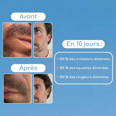 Gel Visage Ultra-frais hydratant et matifiant peaux mixtes à grasses